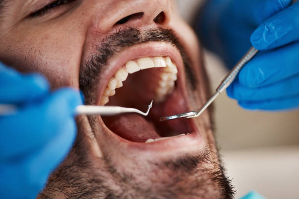 Best Pediatric Emergency Dentist in Carter, TX